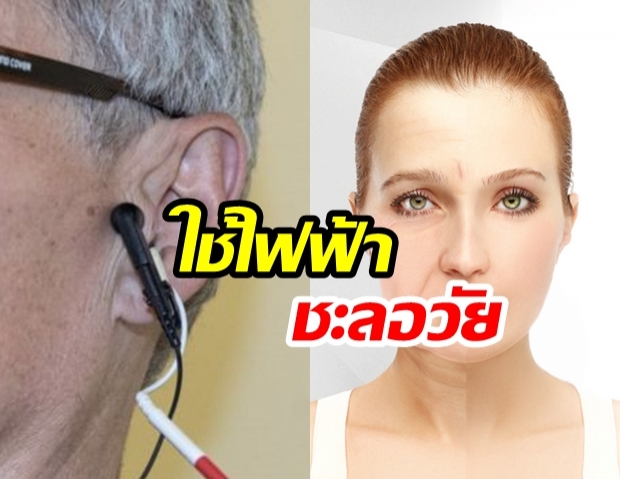  วิธีบำบัดใหม่“ใช้กระแสไฟฟ้าอ่อน” แตะใบหูช่วย “ชะลอวัย” 