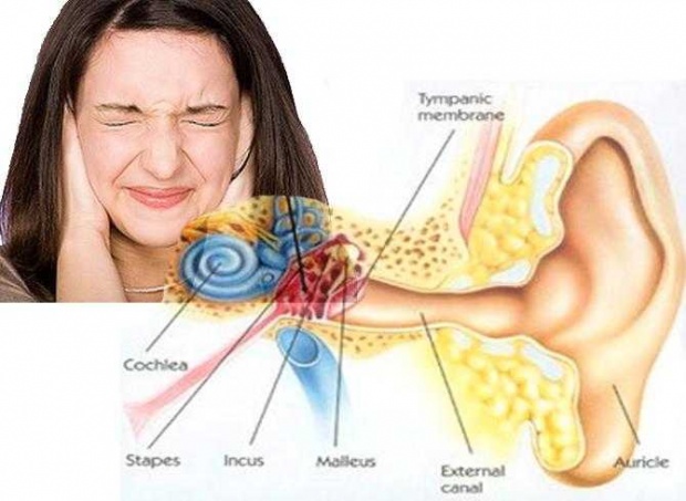โรคน้ำในหูไม่เท่ากันเ สาเหตุและการรักษา