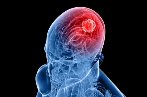 ผลวิจัยระบุชัด”โทรศัพท์มือถือ”ไม่ได้ก่อ”มะเร็งสมอง”