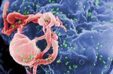 เจ๋งสุดๆ!! นักวิจัยพัฒนายาขจัดเชื้อ HIV ออกจากร่างกายได้ 100%