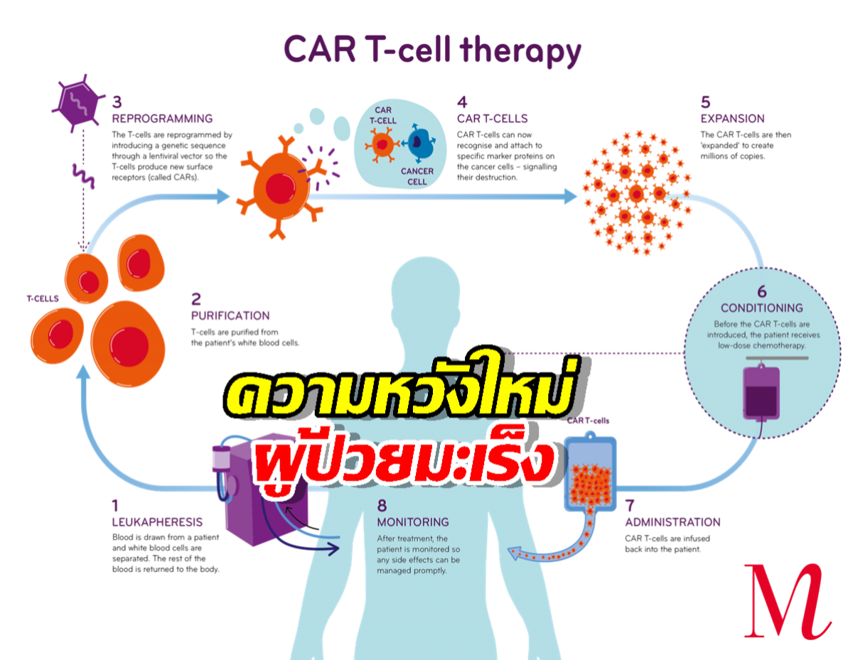 ศิริราชผลิต CAR T-Cell ต้นทุนต่ำ เปิดโอกาสการเข้าถึงการรักษามะเร็ง