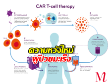 ศิริราชผลิต CAR T-Cell ต้นทุนต่ำ เปิดโอกาสการเข้าถึงการรักษามะเร็ง