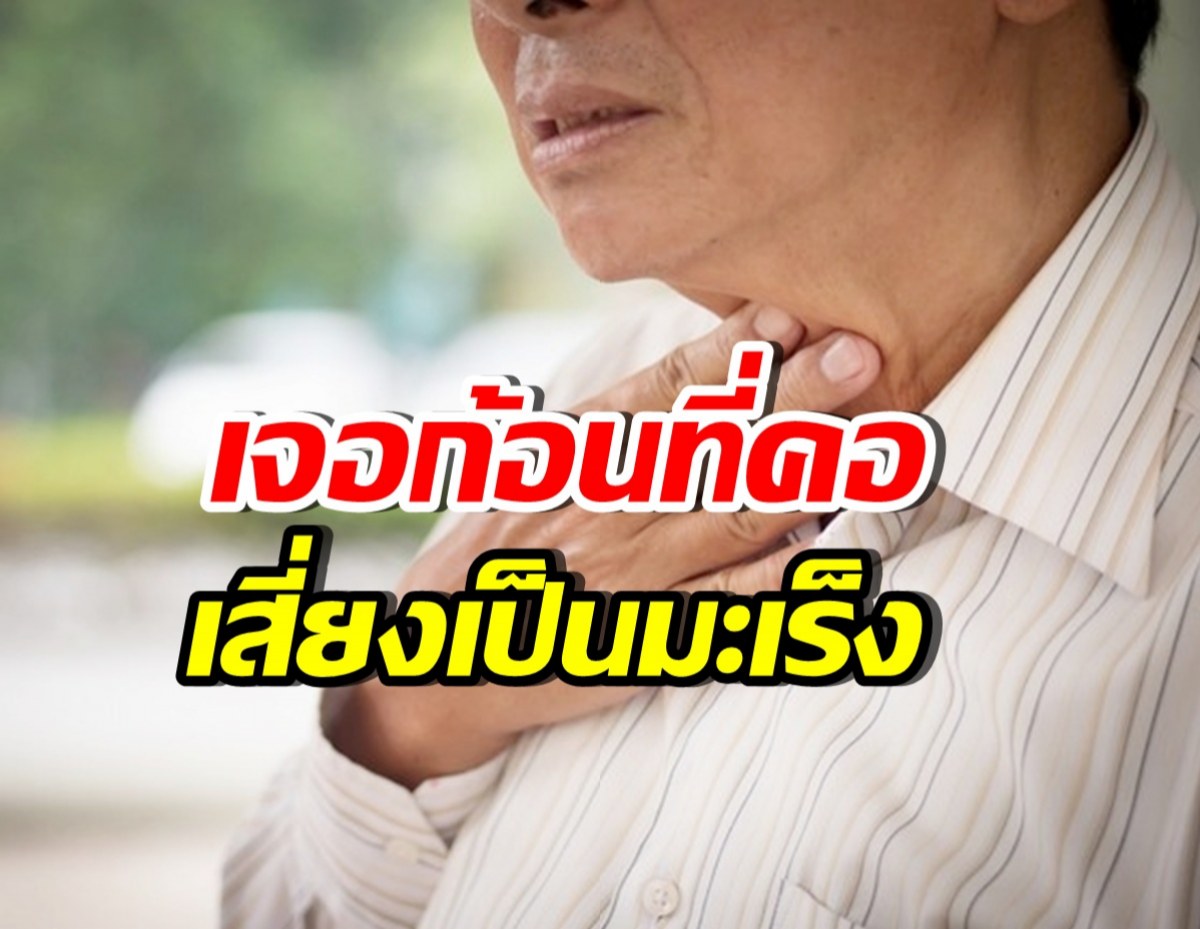 หมอเจด เตือน5ภาวะ คลำเจอก้อนที่คอ เสี่ยงเป็นมะเร็งไม่รู้ตัว