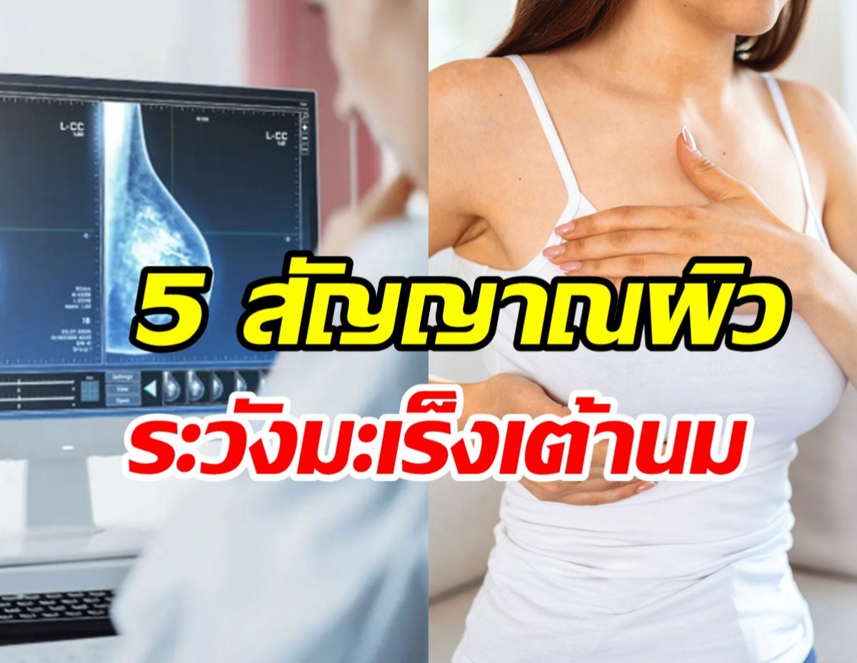 เช็ก! 5 สัญญาณผิวแบบไหนต้องระวังมะเร็งเต้านม