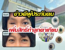 ประกันสังคมเคาะเพิ่มสิทธิ์ทำลูกตาเทียมฟรี เช็กเงื่อนไขด่วน!