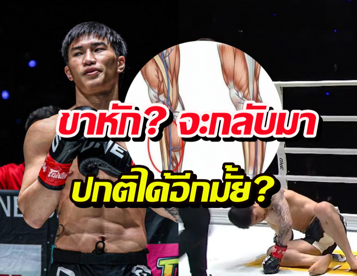 หมอฟันธง ตะวันฉาย ขาหัก? จะกลับมาปกติได้อีกมั้ย?