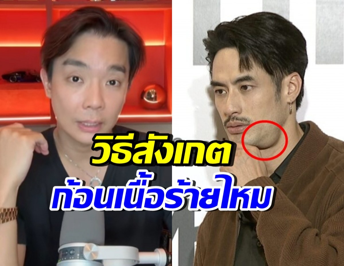 หมอยกเคส บอย ปกรณ์ แนะวิธีสังเกต ก้อนที่คอแบบไหน อันตราย