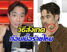 หมอยกเคส บอย ปกรณ์ แนะวิธีสังเกต ก้อนที่คอแบบไหน อันตราย
