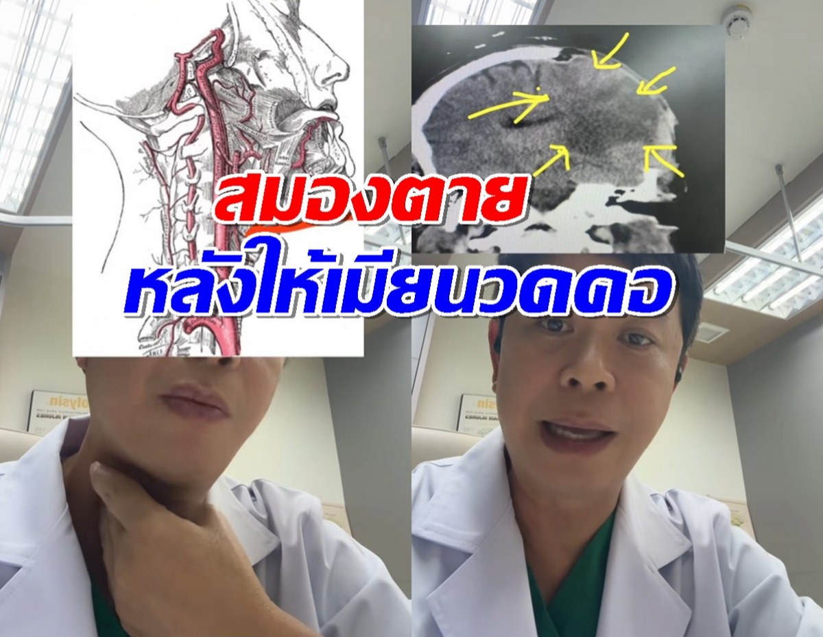 หมอ ยกเคส ผู้ป่วยตื่นเช้ามาแขนขาอ่อนแรง พบสมองตาย หลังให้เมียนวดคอ