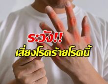 กรดยูริกพุ่ง! หยุดก่อนเก๊าท์จะถามหา!