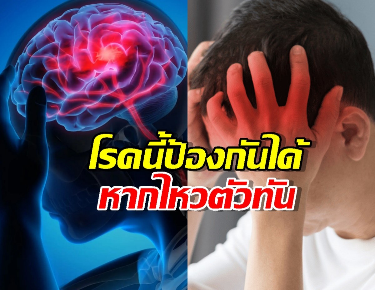 อัมพาตจากหลอดเลือดสมอง: โรคที่ป้องกันได้หาก ไหวตัวทัน