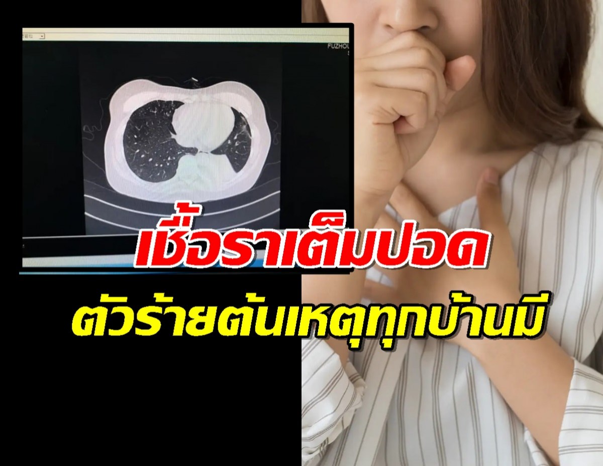 สาวเก็บห้องจู่ๆไข้สูง หมอเจอเชื้อราเต็มปอด คาดมาจากสิ่งที่ทุกบ้านมี!