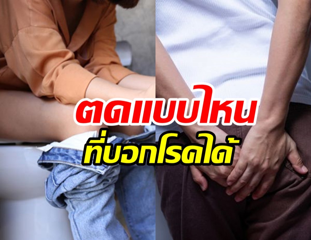 รู้หรือไม่! "ตด" บอกสุขภาพ ผายลมเยอะ-ตดเหม็น เสี่ยงป่วยไหม?