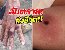 เช็คอาการ แอนแทรกซ์ โรคติดต่อจากสัตว์ ที่ไทยพบผู้เสียชีวิตเเล้ว