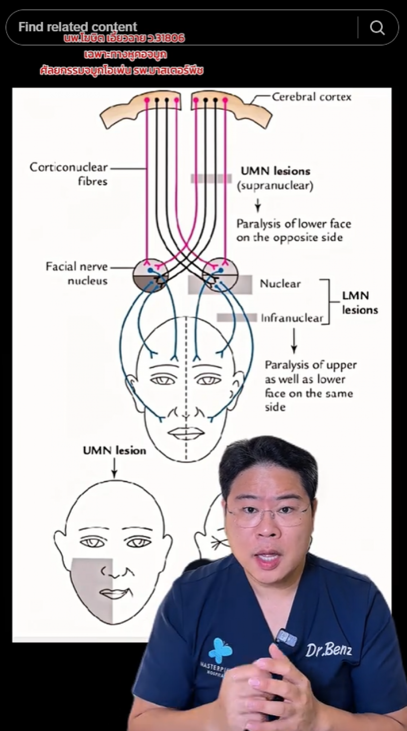 หมอเบ็นซ์ วิเคราะห์อาการ เบิร์ด ธงไชย ชี้ 3 จุดเสี่ยงโรคนี้?
