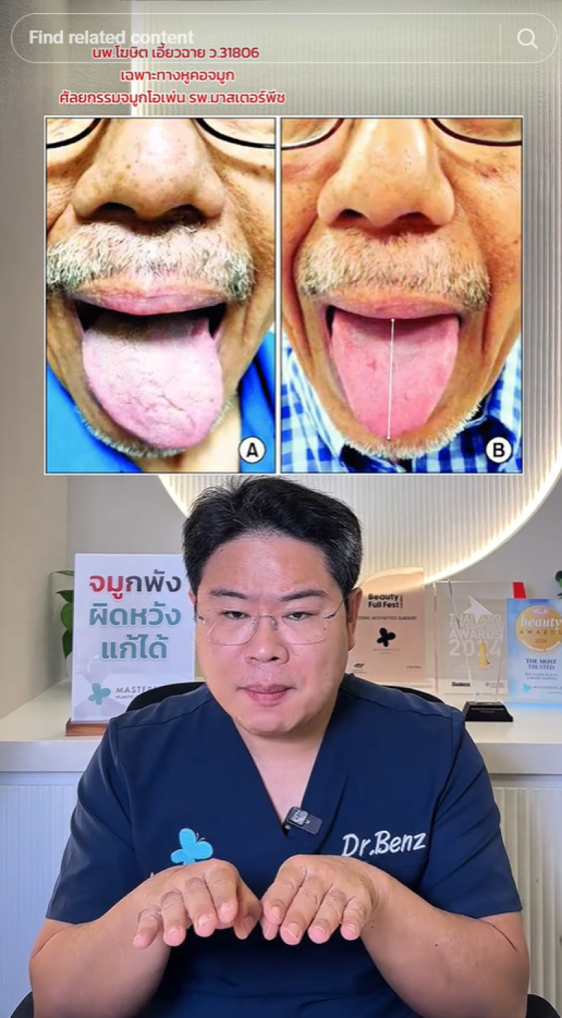 หมอเบ็นซ์ วิเคราะห์อาการ เบิร์ด ธงไชย ชี้ 3 จุดเสี่ยงโรคนี้?