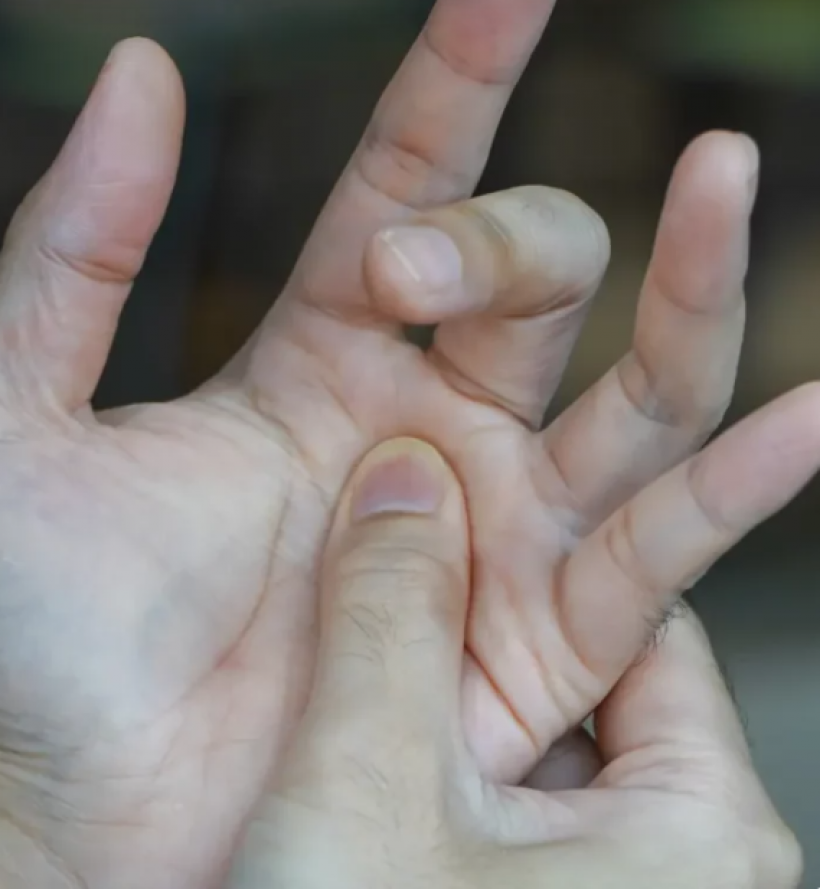 เช็กด่วน! คุณกำลังเสี่ยง โรคนิ้วล็อค อยู่หรือไม่?