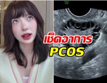 PCOS คืออะไร โรคนี้เกิดกับสาวๆ พลอยชมพู กำลังเผชิญ!